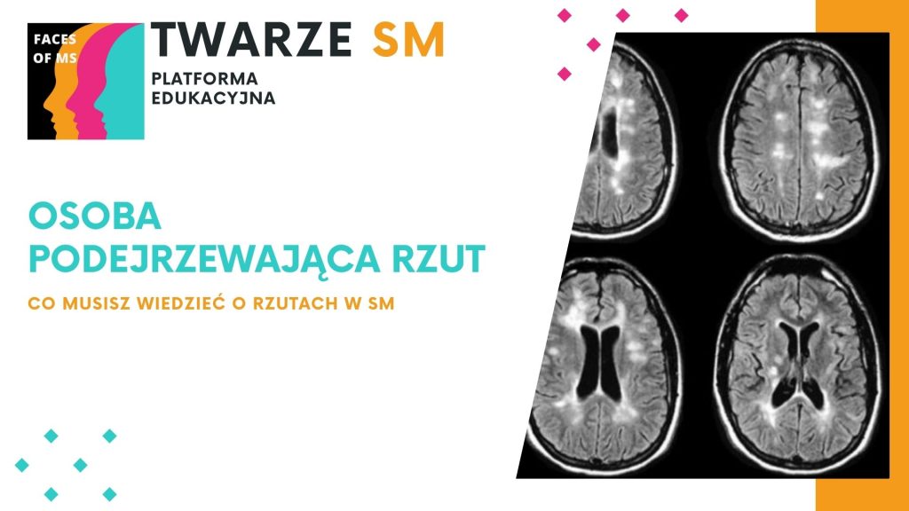 stwardnienie rozsiane rzut choroby, co to jest rzut choroby