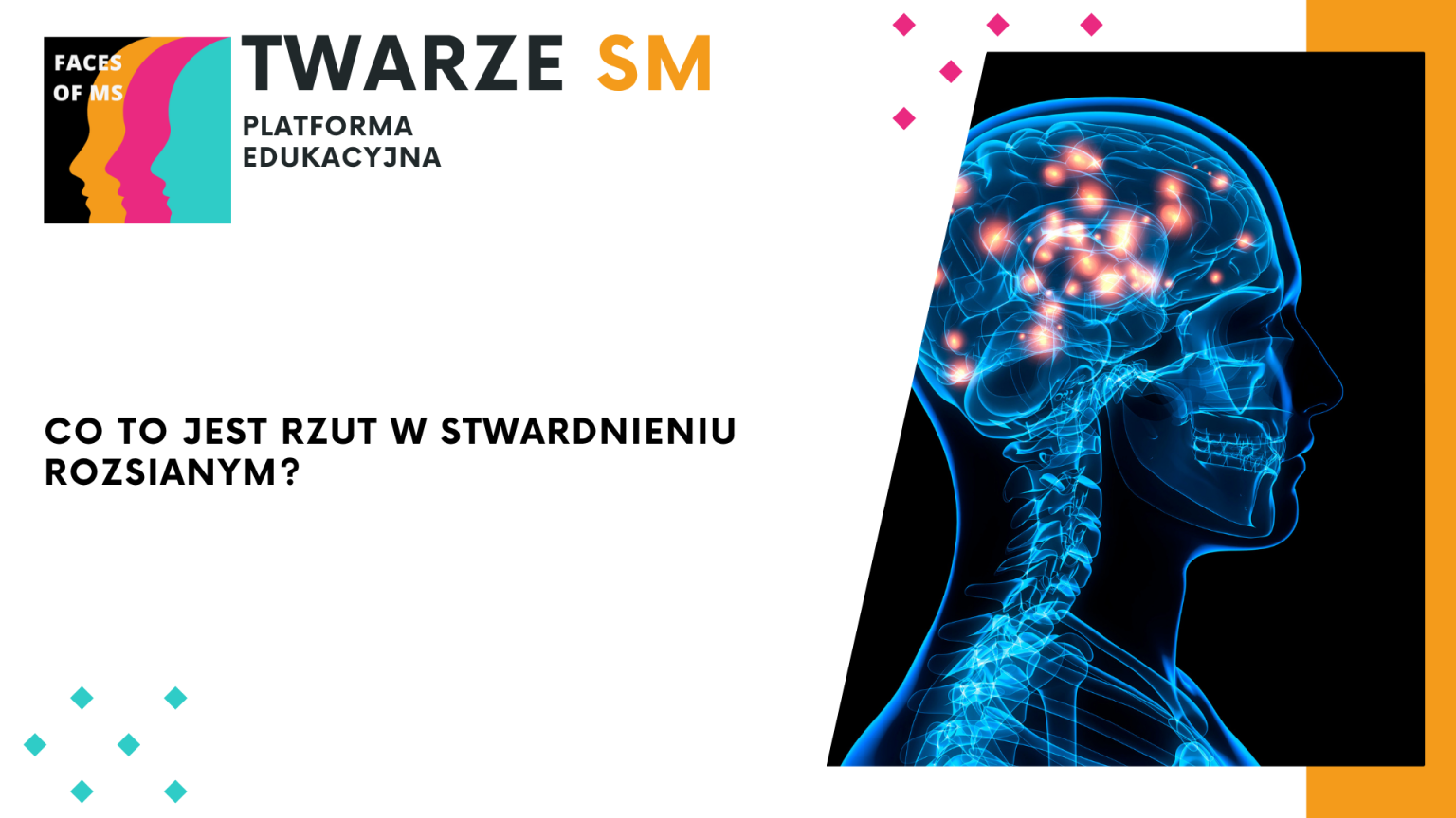rzut stwardnienie rozsiane