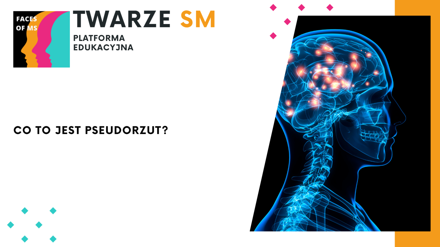 pseudorzut stwardnienie rozsiane