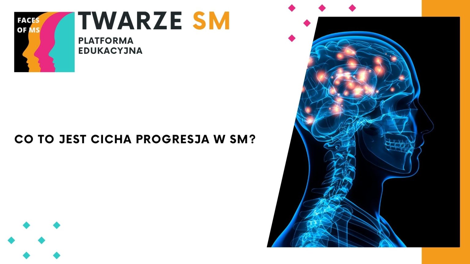 PIRA, cicha progresja stwardnienie rozsiane