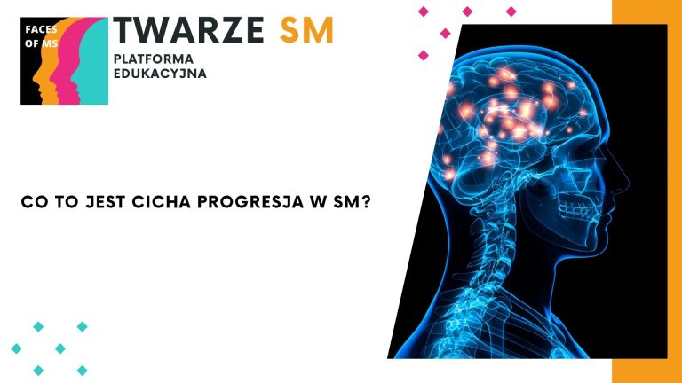 PIRA, cicha progresja stwardnienie rozsiane